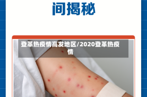 登革热疫情高发地区/2020登革热疫情