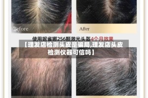 【理发店检测头皮是骗局,理发店头皮检测仪器可信吗】