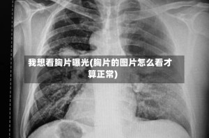 我想看胸片曝光(胸片的图片怎么看才算正常)