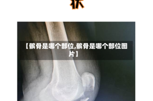 【髌骨是哪个部位,髌骨是哪个部位图片】