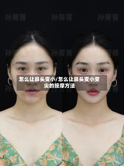 怎么让鼻头变小/怎么让鼻头变小变尖的按摩方法-第1张图片