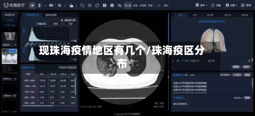 现珠海疫情地区有几个/珠海疫区分布-第1张图片