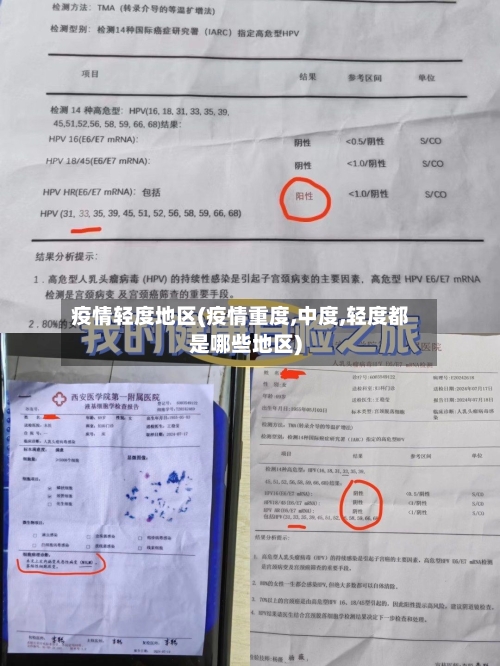 疫情轻度地区(疫情重度,中度,轻度都是哪些地区)-第1张图片