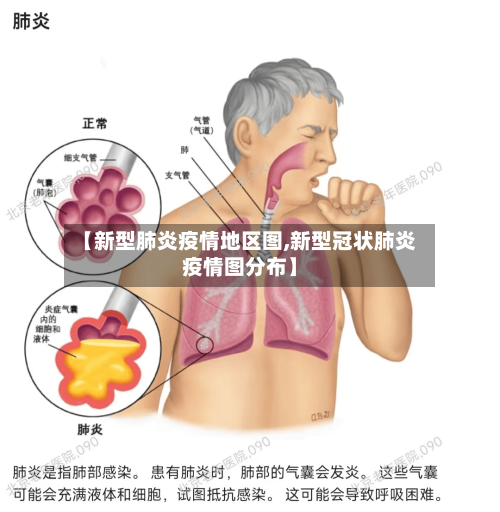 【新型肺炎疫情地区图,新型冠状肺炎疫情图分布】-第1张图片